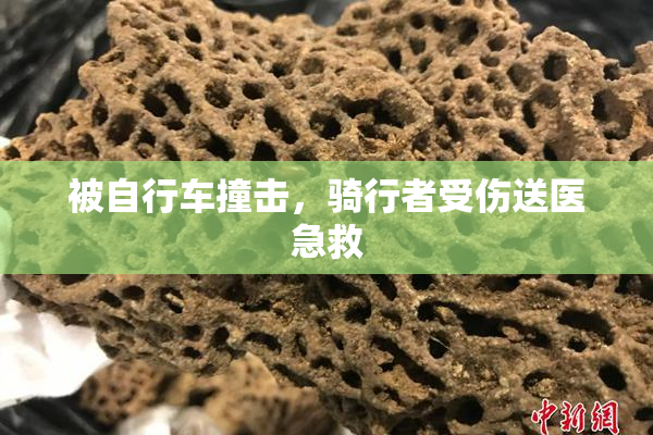 被自行车撞击，骑行者受伤送医急救