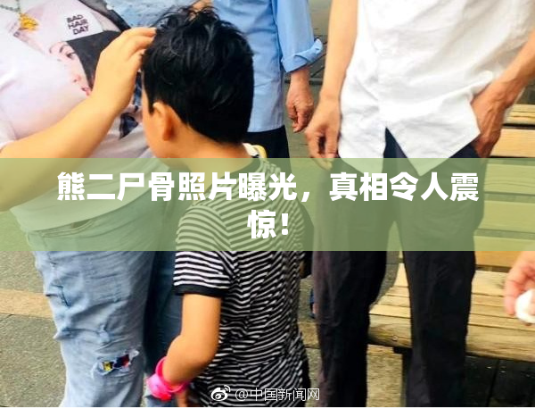 熊二尸骨照片曝光，真相令人震惊！