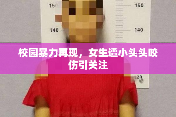 校园暴力再现，女生遭小头头咬伤引关注