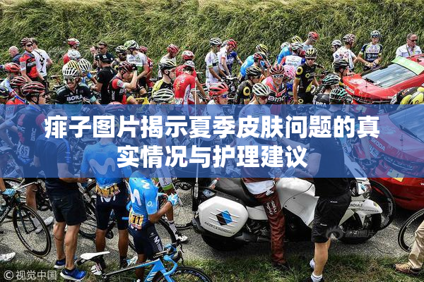 痱子图片揭示夏季皮肤问题的真实情况与护理建议
