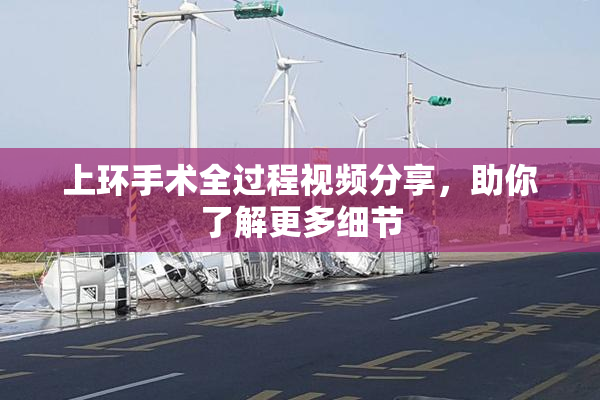 上环手术全过程视频分享，助你了解更多细节