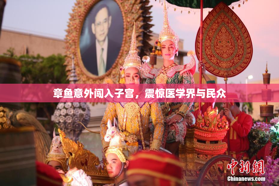 章鱼意外闯入子宫，震惊医学界与民众
