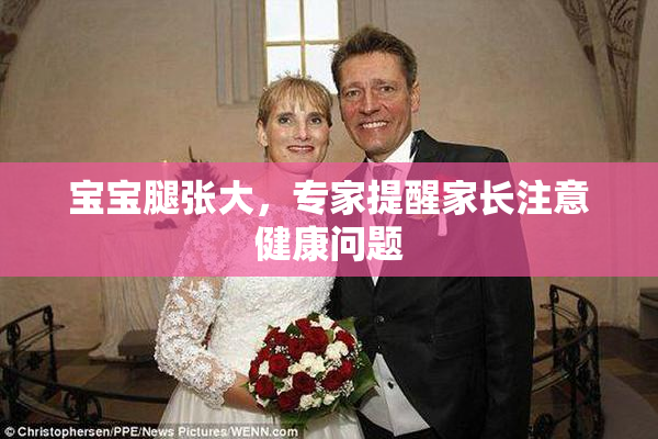宝宝腿张大，专家提醒家长注意健康问题