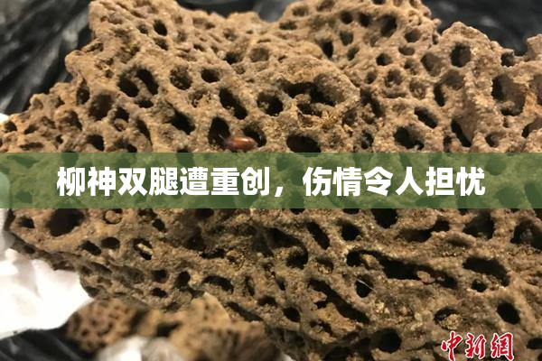 柳神双腿遭重创，伤情令人担忧