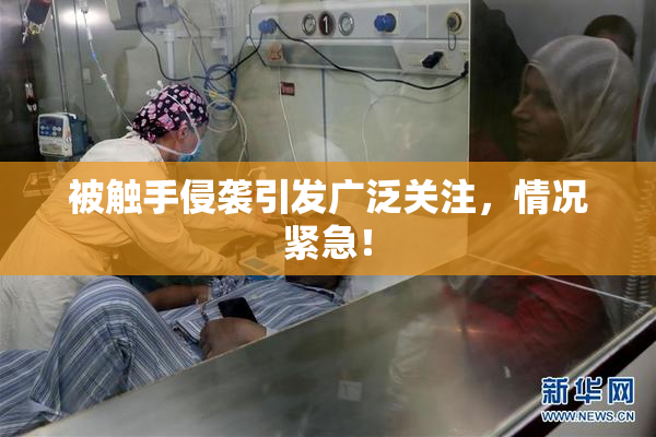 被触手侵袭引发广泛关注，情况紧急！