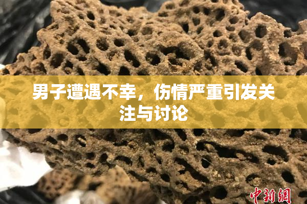 男子遭遇不幸，伤情严重引发关注与讨论