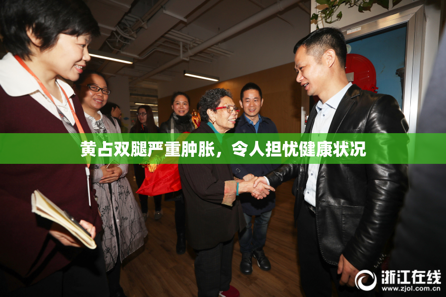 黄占双腿严重肿胀，令人担忧健康状况