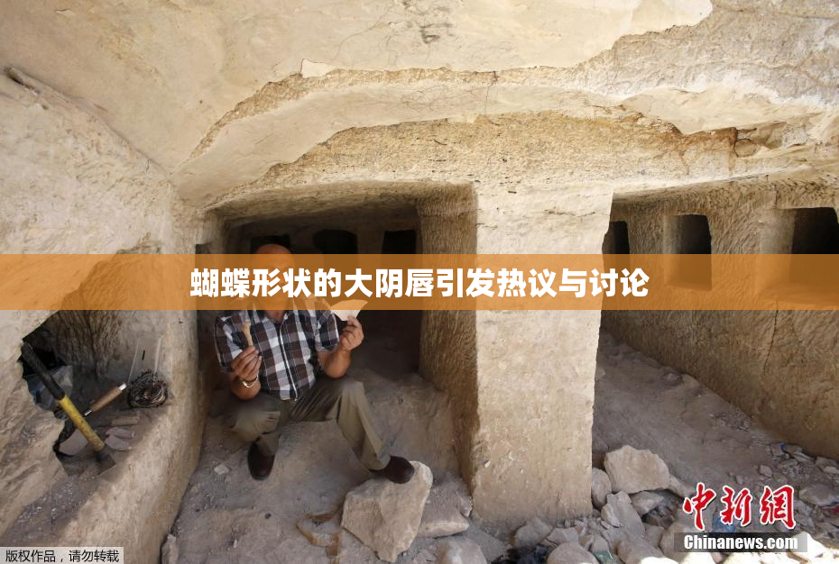 蝴蝶形状的大阴唇引发热议与讨论