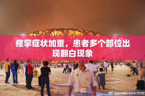 痉挛症状加重，患者多个部位出现翻白现象