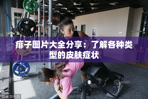 痱子图片大全分享：了解各种类型的皮肤症状
